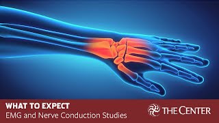 What to Expect During Nerve Conduction Studies and EMG Tests [upl. by Anelat718]