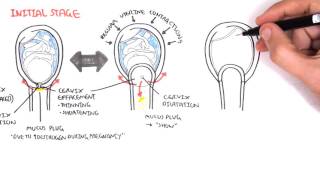 Obstetrics  Stage I of Labour [upl. by Zacek]