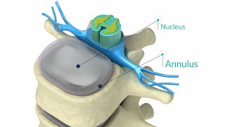 Open Reduction Internal Fixation of Patella [upl. by Ekez]