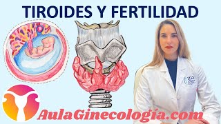 TIROIDES y FERTILIDAD hormonas tiroideas y EMBARAZO Abortos  Ginecología y Obstetricia [upl. by Eidod]