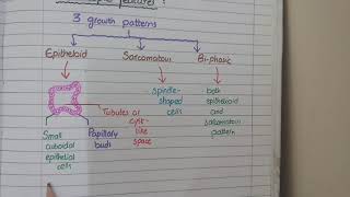 About Stage 2 Pleural Mesothelioma [upl. by Meagan]