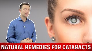 How to Prevent Cataracts With Natural Remedies – Dr Berg [upl. by Schriever785]