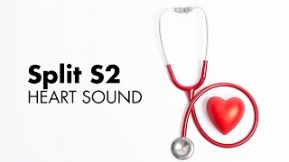 Fixed Split S2  Heart Sounds  MEDZCOOL [upl. by Llabmik687]