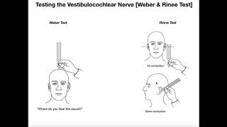 Interpreting the WeberRinne Tests EXPLAINED [upl. by Elin]