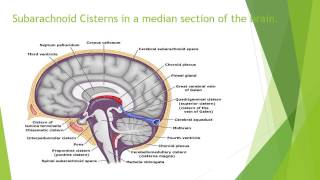 Subarachnoid Cisterns – Anatomy [upl. by Gladdy]