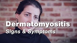 The Myositis Association Patient stories Polymyositis [upl. by Yannodrahc640]