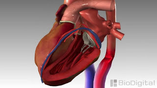 3D Medical Animation  Congestive Heart Failure [upl. by Herby517]