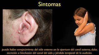 otitis externa ESPANOL [upl. by Naoh]