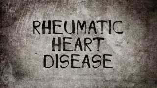 Rheumatic Fever amp Heart Disease Part 77 [upl. by Nagar483]