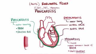 Rheumatic Fever amp Heart Disease  Part 17 🫀 [upl. by Hasan]