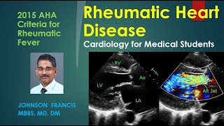 Myocardial Infarction Heart Attack for Nursing amp NCLEX [upl. by Etom492]