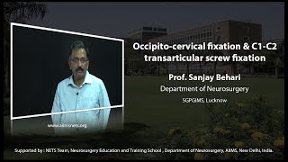 Occipitocervical fixation and C1C2 transarticular screw fixation [upl. by Iatnwahs]