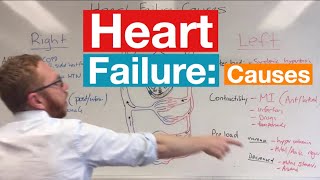 Heart Failure Causes [upl. by Sidky]