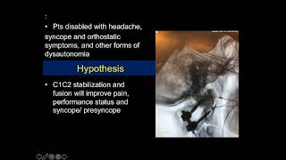 Atlantoaxial Rotary Instability Findings and Treatment Outcomes Research  Dr Fraser Henderson [upl. by Suixela]