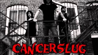 Cancerslug  Generation Behind  seasons of sickness [upl. by Oslec259]