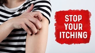 What Causes Hives and Itchiness  Urticaria Hives Treatment  Dr Berg [upl. by Retsevel]