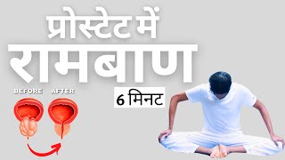 प्रोस्टेट के लिए रामबाण हैं ये 6 योगासन और उनके लाभ  Yoga for Prostate Problems Hindi [upl. by Casar]