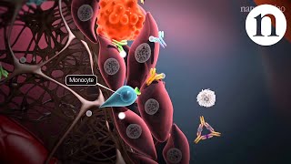 Valvular Heart Disease for the Noncardiologist [upl. by Seidule714]