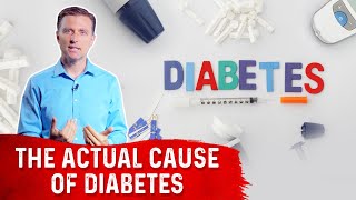 The Underlying Cause Of Diabetes – DrBerg [upl. by Matty]