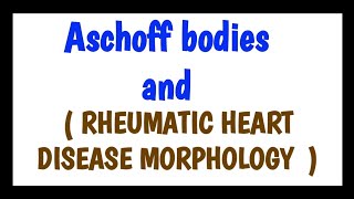 Rheumatic Fever amp Heart Disease  Pathology  Dr Najeeb🫀 [upl. by Cirderf]