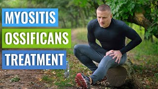 Myositis Ossificans Causes amp Treatment [upl. by Adnilem]