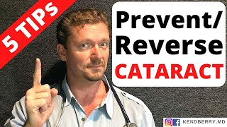 PreventReverse CATARACTS with These 5 Tips [upl. by Ominoreg286]