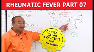 Rheumatic Fever Symptoms Treatment and Causes [upl. by Giess334]